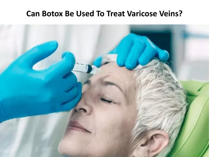 can botox be used to treat varicose veins