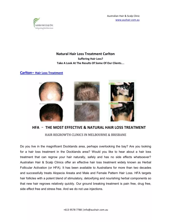 australian hair scalp clinic www aushair com au