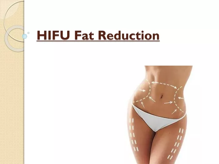 hifu fat reduction