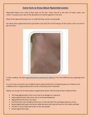 some facts to know about pigmented lesions