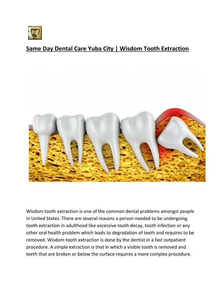 same day dental care yuba city wisdom tooth