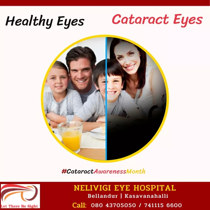cataract eyes