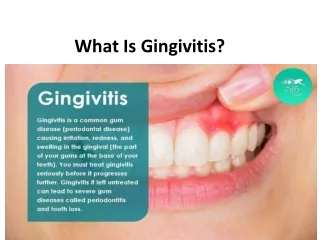 What Is Gingivitis?