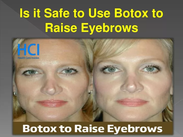 is it safe to use botox to raise eyebrows