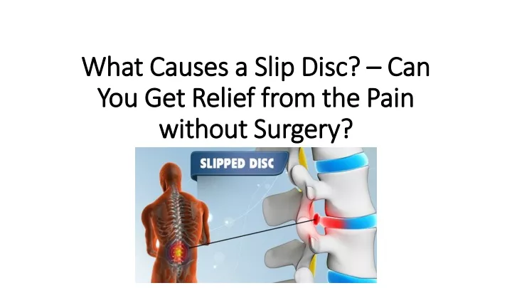 what causes a slip disc can you get relief from the pain without surgery