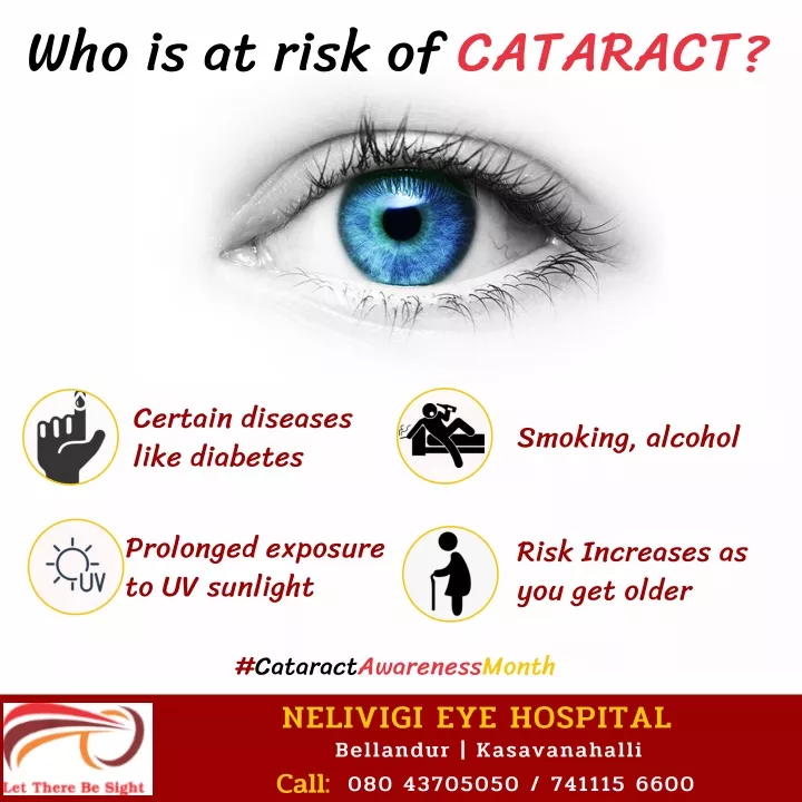 who is at risk of cataract