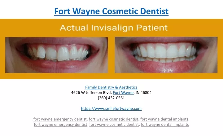 fort wayne cosmetic dentist