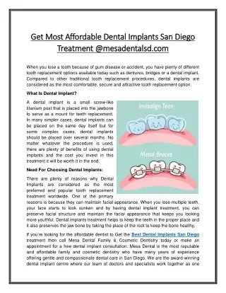 Get Most Affordable Dental Implants San Diego Treatment @mesadentalsd.com