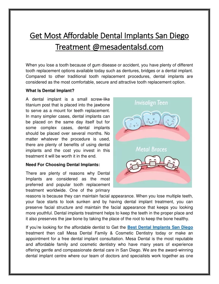 get most affordable dental implants san diego