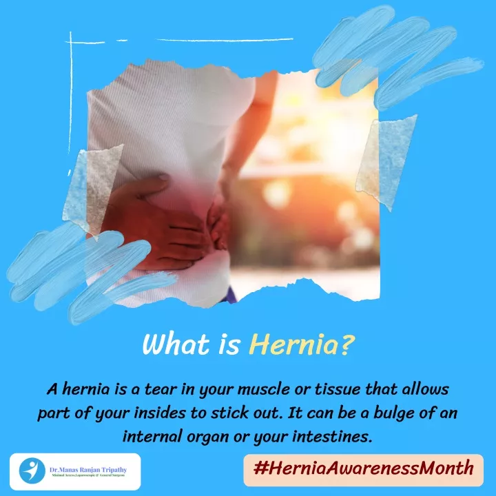 what is hernia a hernia is a tear in your muscle