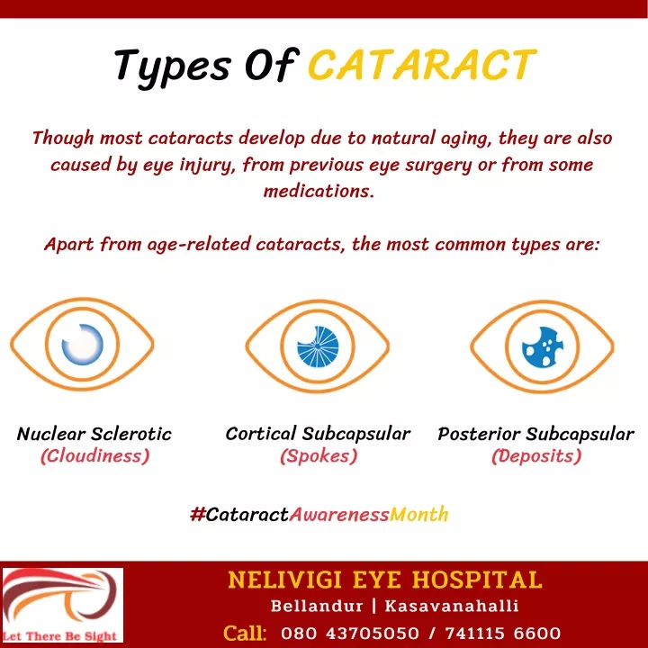 types of cataract