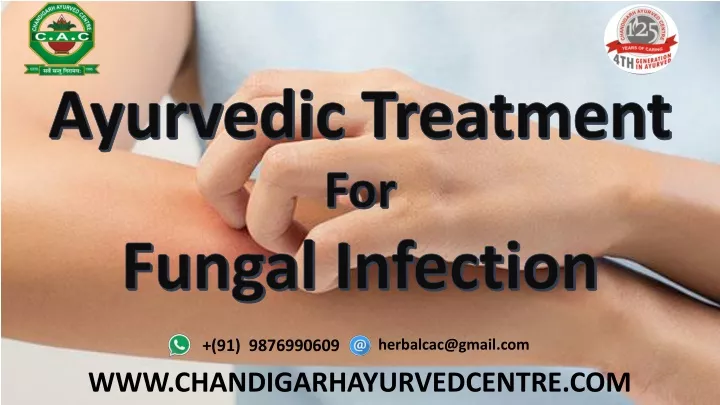 ayurvedic treatment for fungal infection