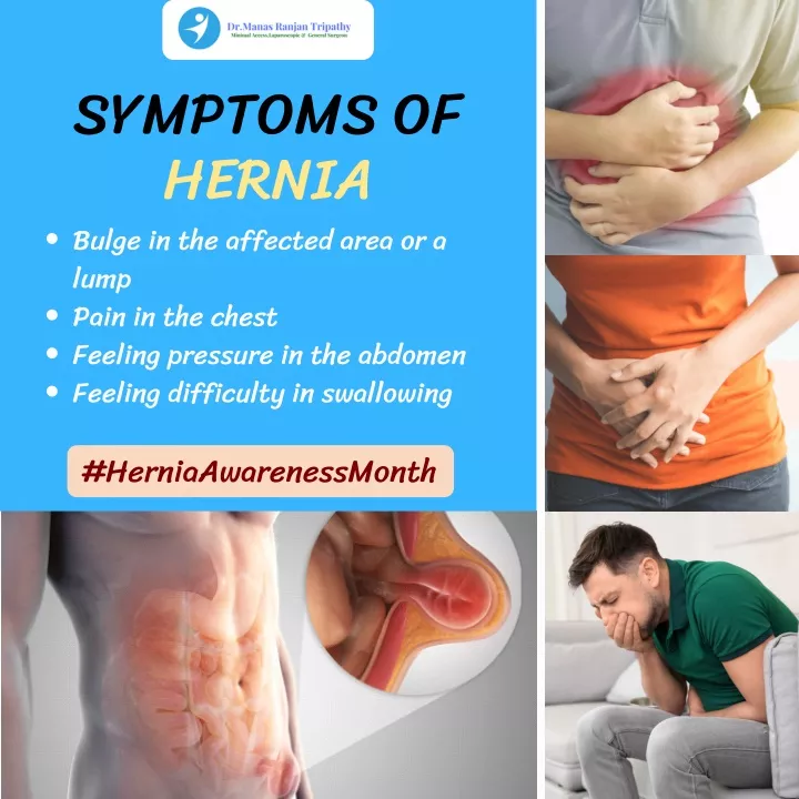 symptoms of hernia bulge in the affected area