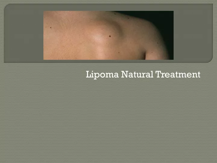 lipoma natural treatment