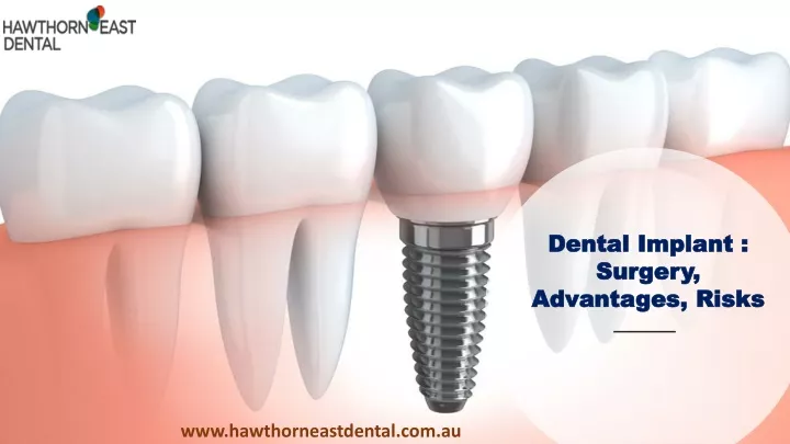 dental implant surgery advantages risks
