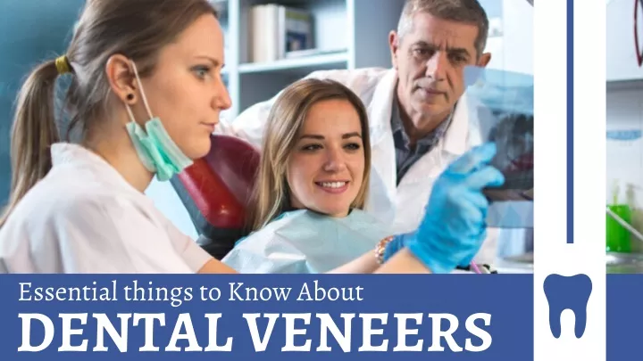 essential things to know about dental veneers