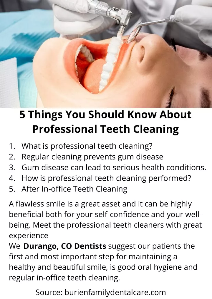 5 things you should know about professional teeth