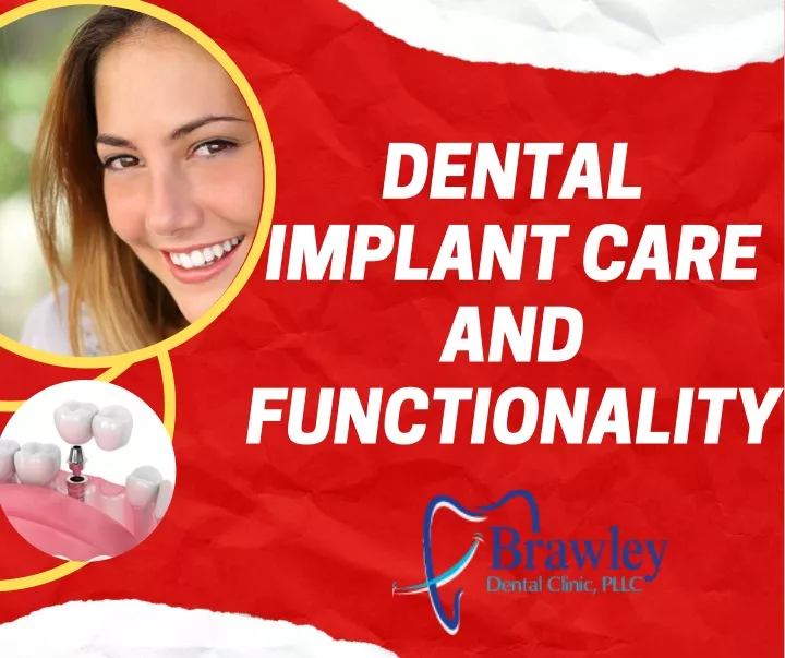 dental implant care and functionality