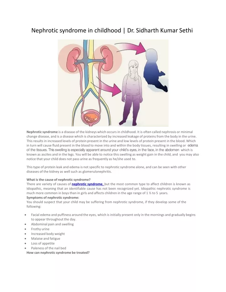 nephrotic syndrome in childhood dr sidharth kumar