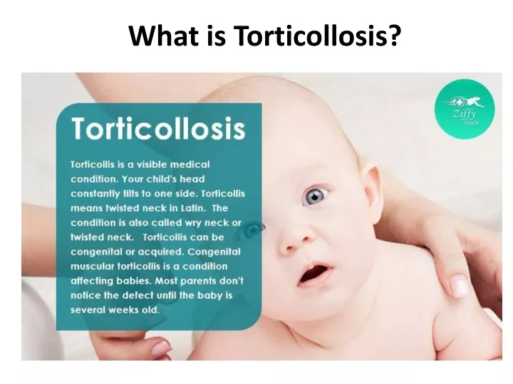 what is torticollosis