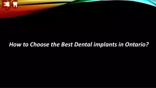 How to choose the best dental implants in ontario?