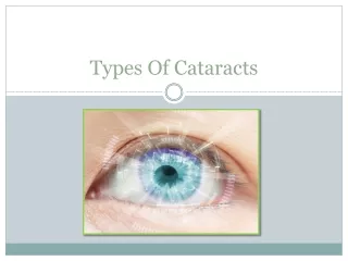 What Are The Types Of Cataracts? Know With Dr. Swati Sinkar
