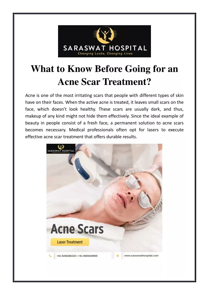 what to know before going for an acne scar