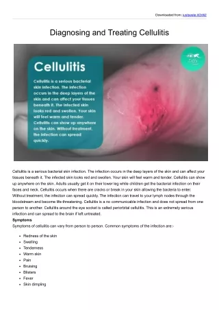 Diagnosing and Treating Cellulitis