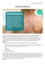 PPT - Chickenpox (Varicella) PowerPoint Presentation, free download ...