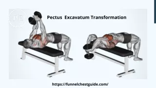 Know About Pectus  Excavatum Transformation  - Funnel Chest Guide