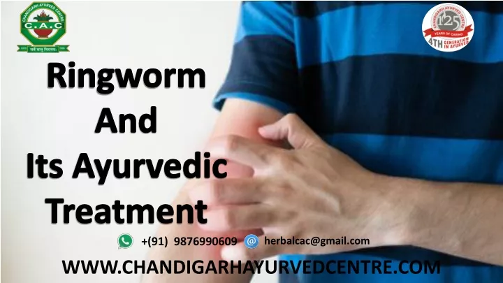 ringworm and its ayurvedic treatment