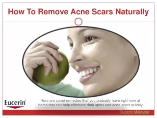 Natural Ways To Get Rid Of Acne Scars – Eucerin Acne Solutions