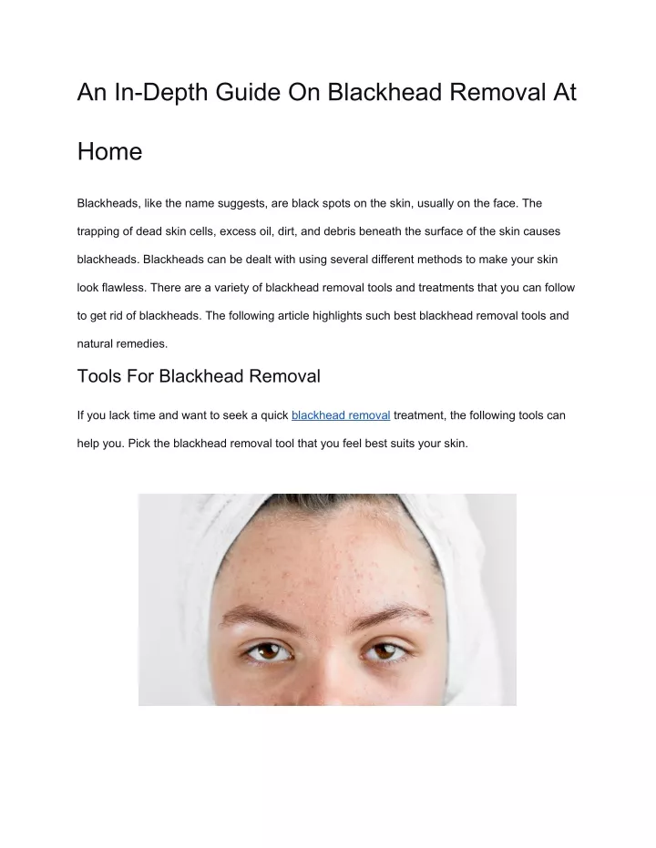 an in depth guide on blackhead removal at