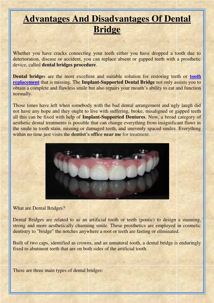 advantages and disadvantages of dental bridge