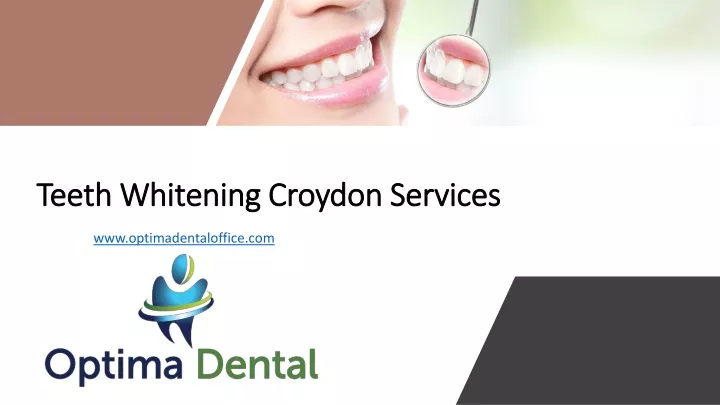 teeth whitening croydon services