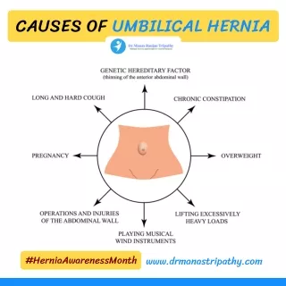 Umbilical Hernia Causes | Laparoscopic Hernia Treatment Near Me in Bangalore | Dr. Manas Tripathy