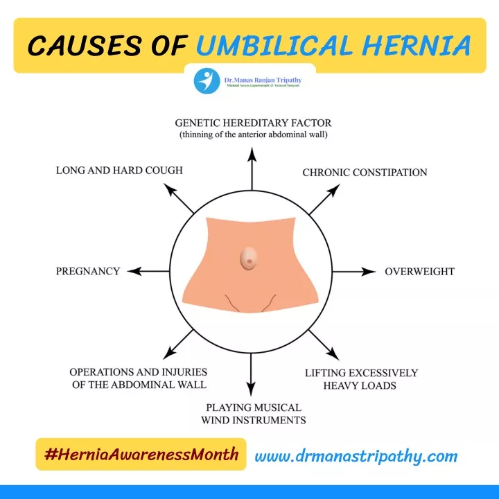 causes of umbilical hernia