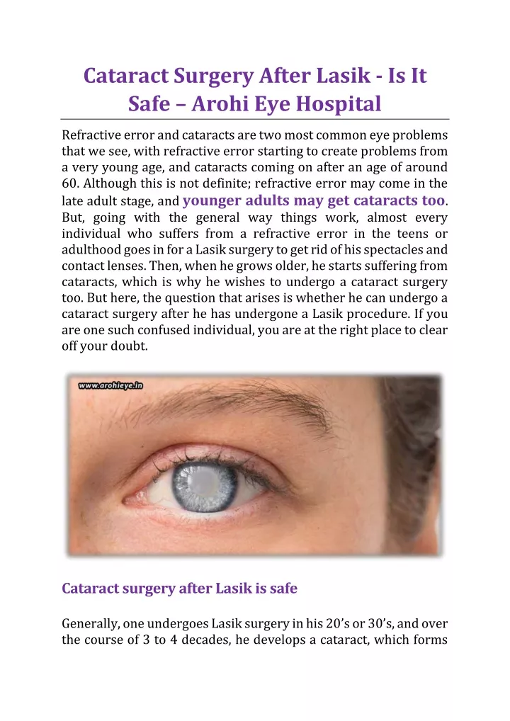 cataract surgery after lasik is it safe arohi