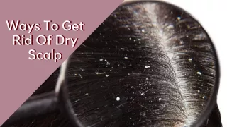 Way To Get Rid Of Dry Scalp