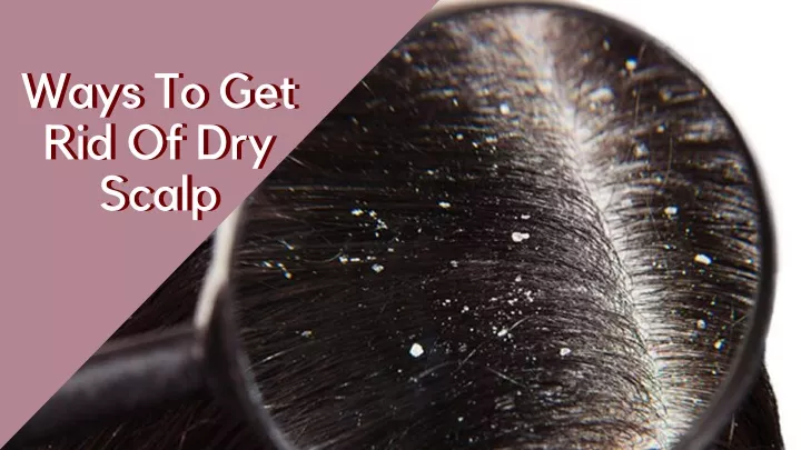 ways to get rid of dry