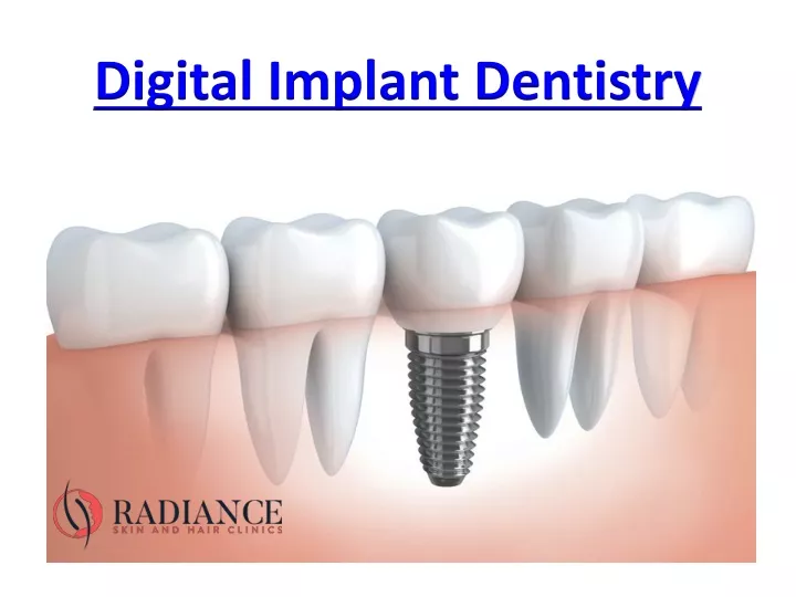 digital implant dentistry