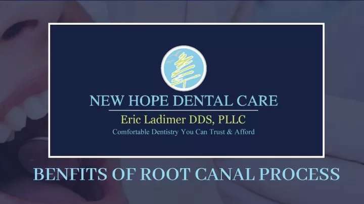 benfits of root canal process