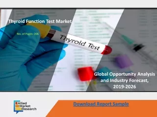 opportunity analysis and industry forecast 2016