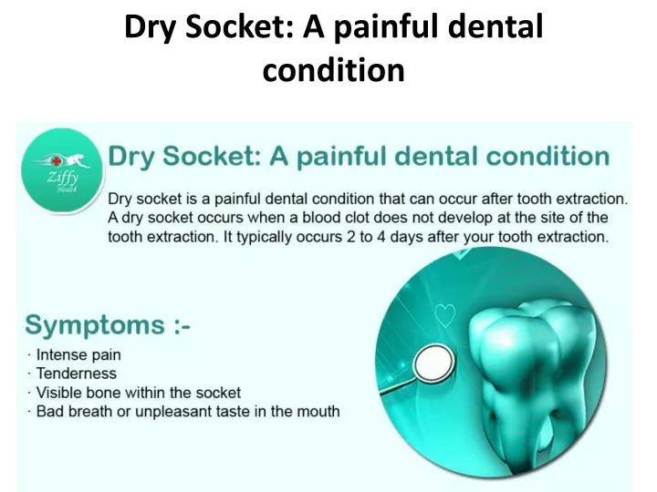 dry socket a painful dental condition