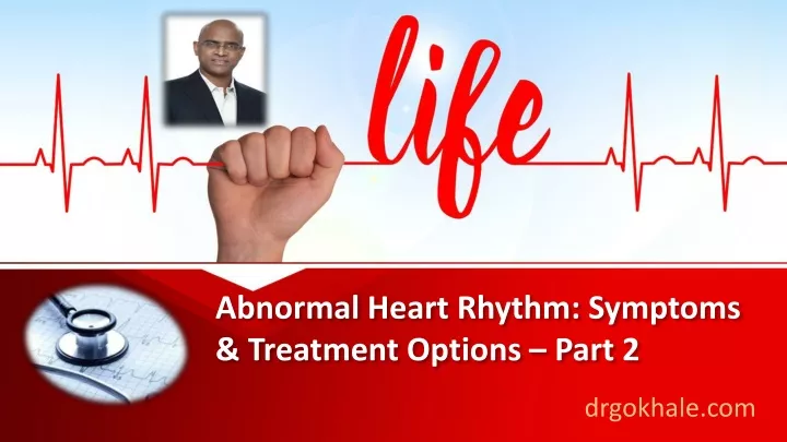 abnormal heart rhythm symptoms treatment options part 2