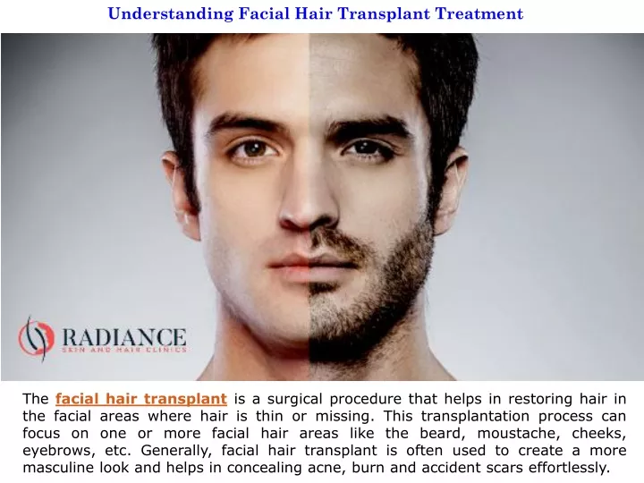 understanding facial hair transplant treatment