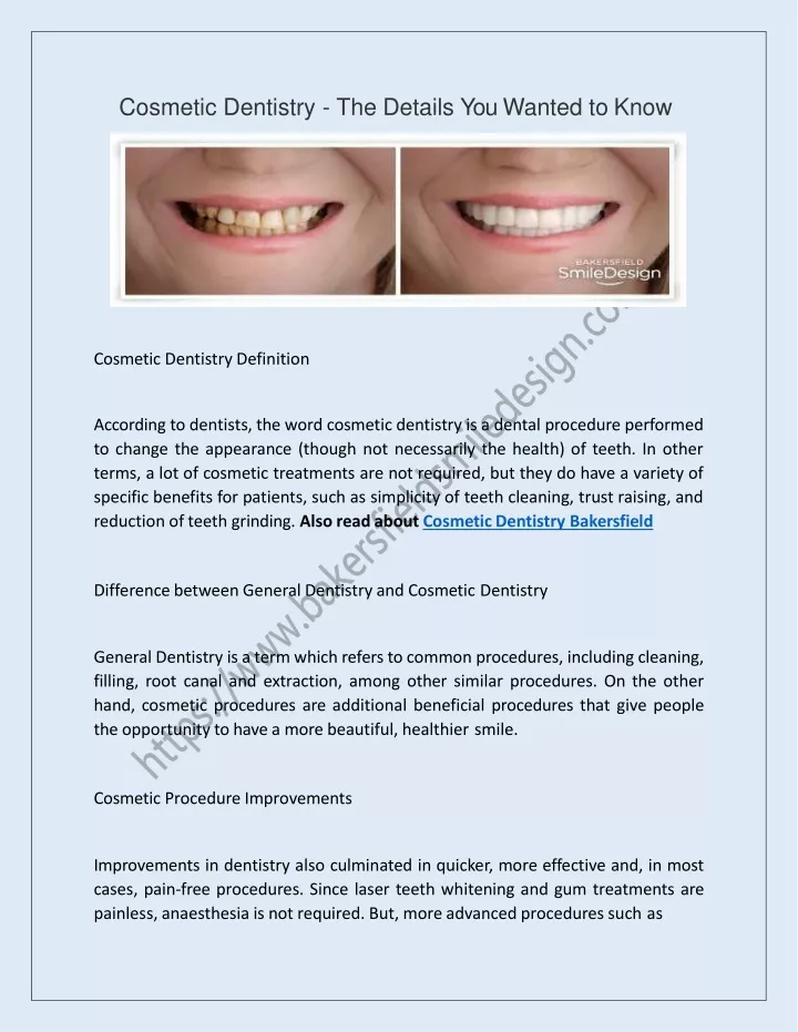 cosmetic dentistry the details you wanted to know
