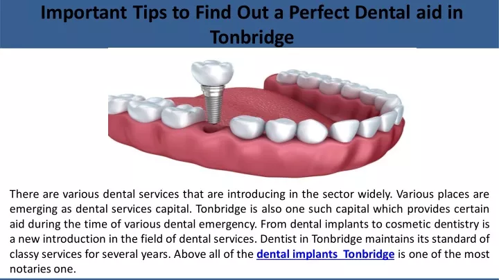important tips to find out a perfect dental