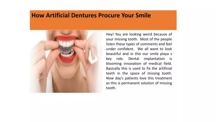 how artificial dentures procure your smile