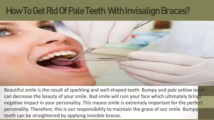 how to get rid of pale teeth with invisalign braces